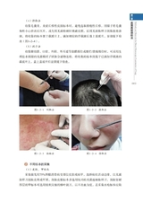 常见真菌感染性疾病直接镜检图谱2022年10月第1期
