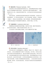 常见真菌感染性疾病直接镜检图谱2022年10月第1期