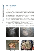 常见真菌感染性疾病直接镜检图谱2022年10月第1期
