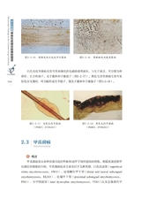 常见真菌感染性疾病直接镜检图谱2022年10月第1期
