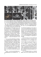 医学影像学杂志2025年5月第5期