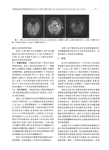 中国神经免疫学和神经病学杂志2020年3月第2期