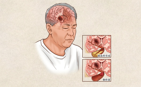药物与人