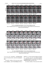 中国医学物理学杂志2025年10月第10期