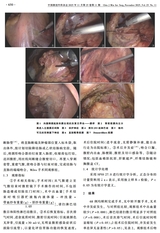 中国微创外科杂志2025年11月第11期