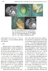 中国微创外科杂志2025年11月第11期
