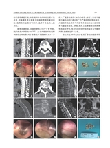 骨科临床与研究杂志2025年11月第6期