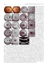 眼科2025年5月第3期